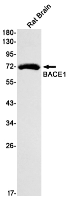 BACE1 Rabbit mAb