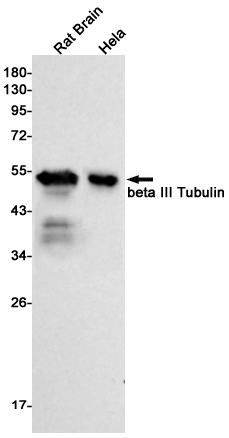 beta III Tubulin Rabbit mAb