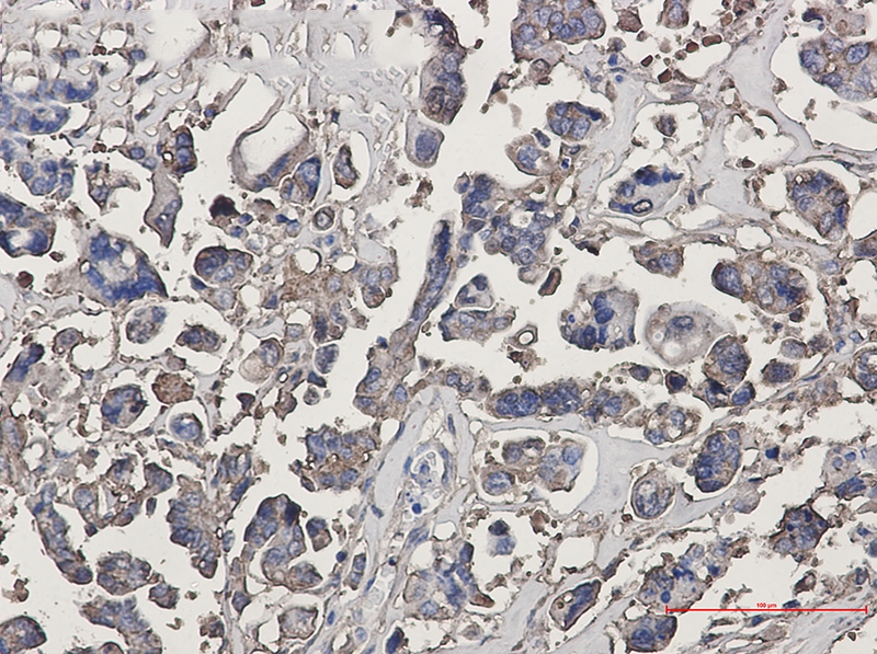 beta III Tubulin Rabbit mAb