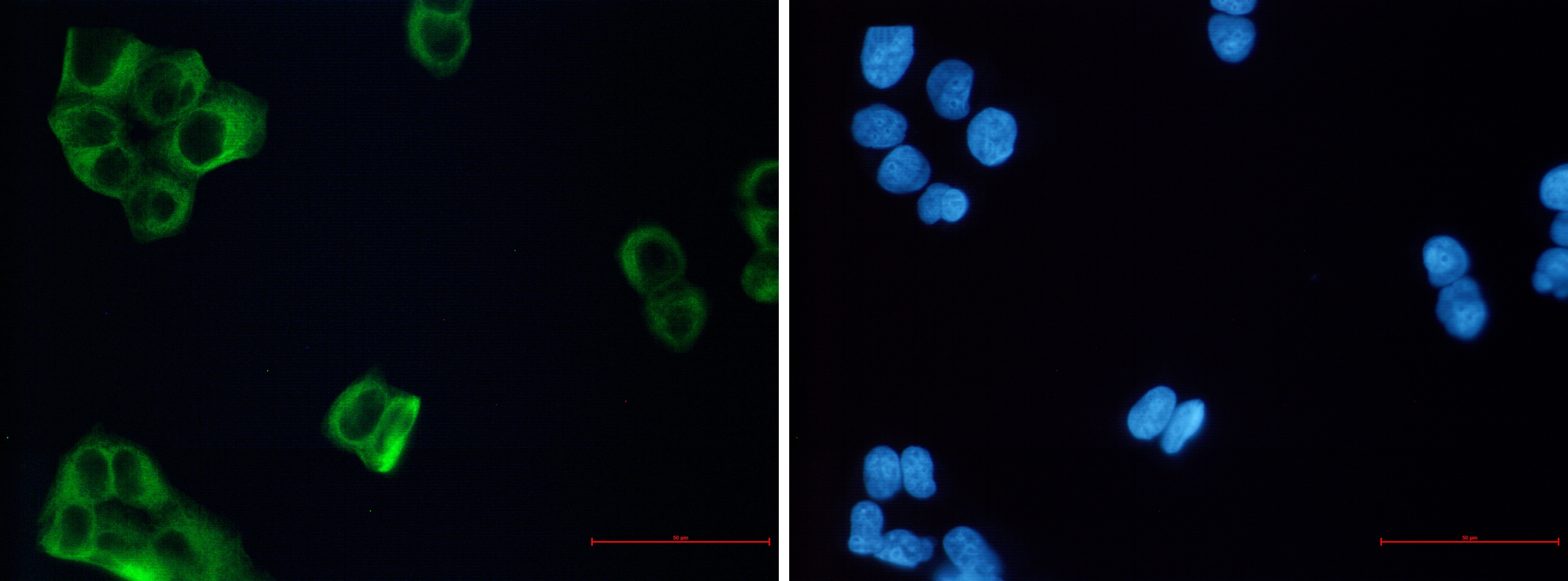 beta III Tubulin Rabbit mAb