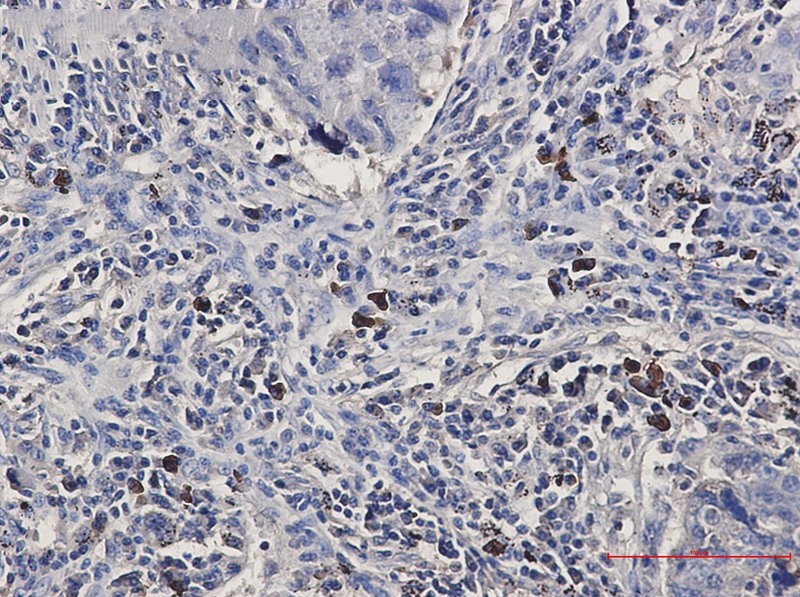 BNIP3L Rabbit mAb