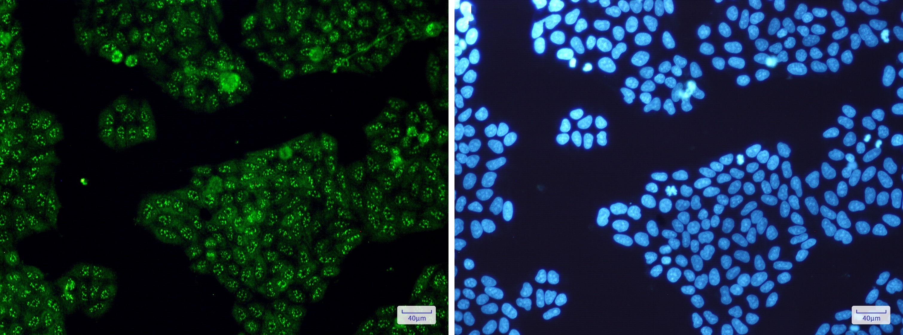 Calretinin Rabbit mAb