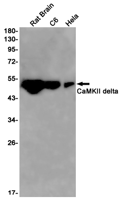 CaMKII delta Rabbit mAb