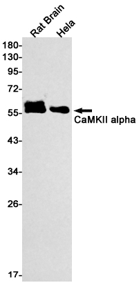 CaMKII alpha Rabbit mAb