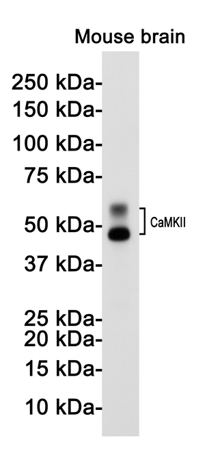 CaMKII beta Rabbit mAb