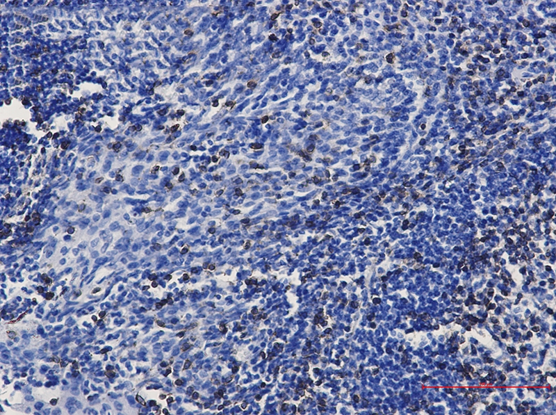 CD3 epsilon Rabbit mAb