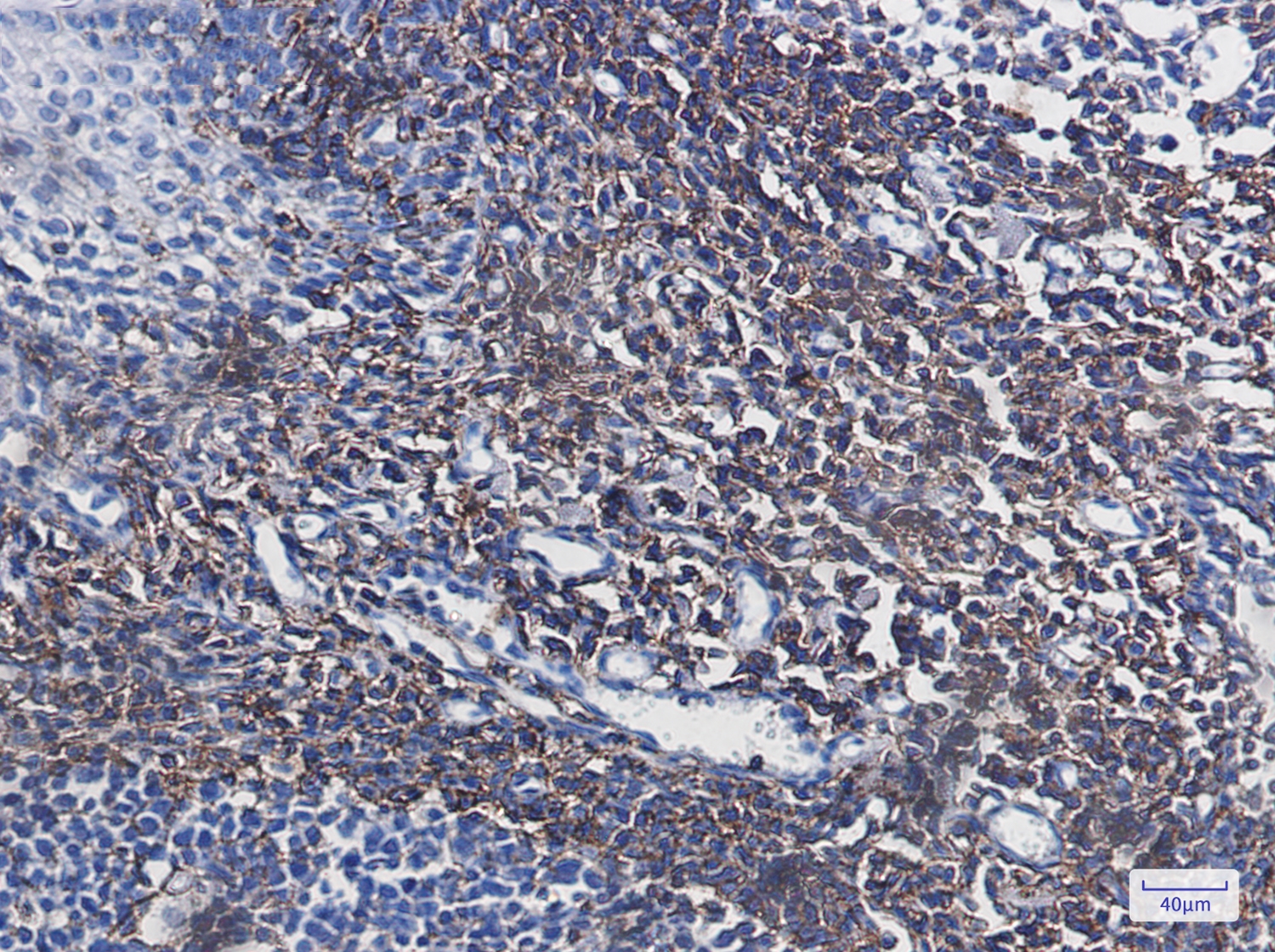 CD44 Rabbit mAb