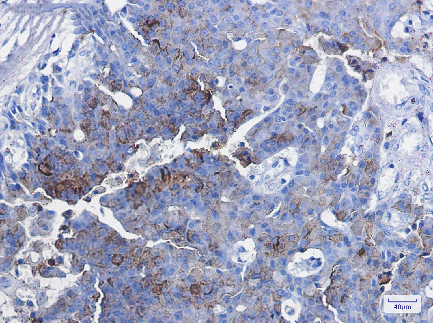 CD63 Rabbit mAb