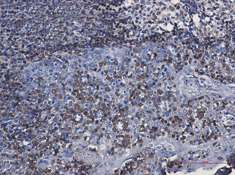 CD79a Rabbit mAb