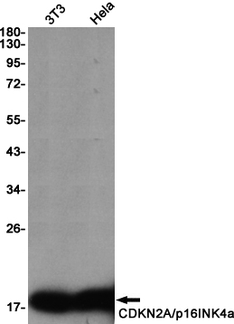 CDKN2A Rabbit mAb