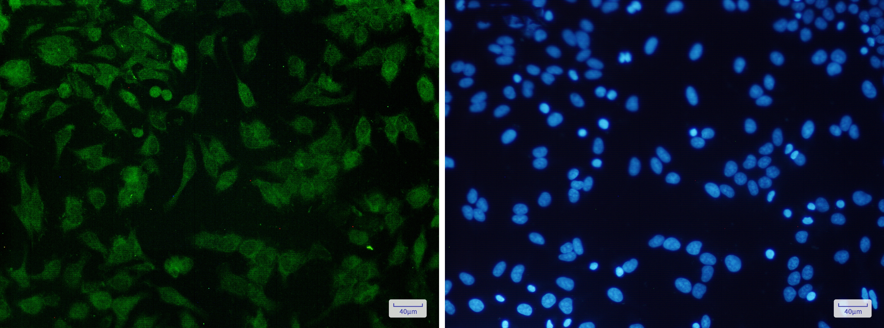 CDKN2A Rabbit mAb