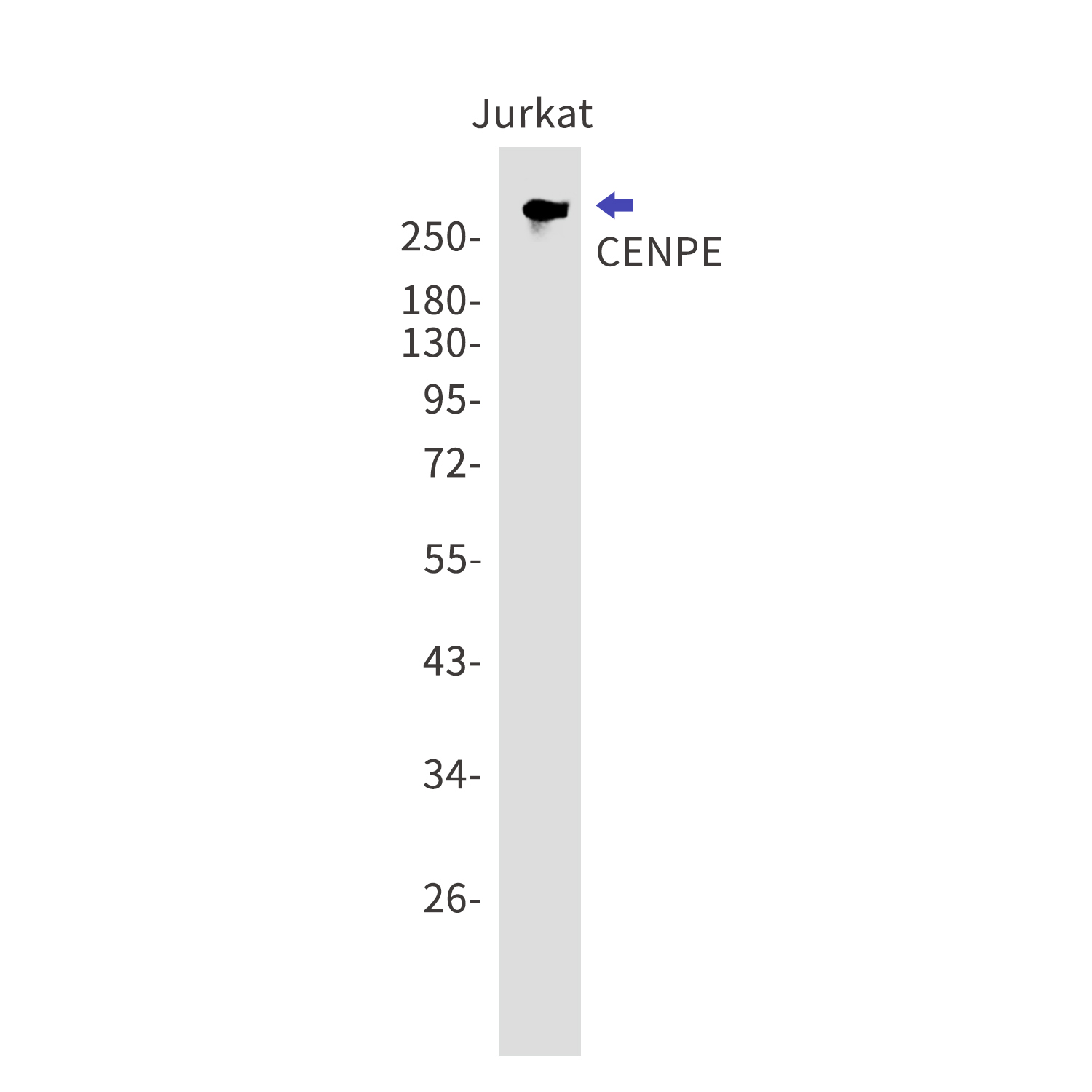 CENPE Rabbit mAb