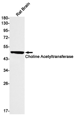 Choline Acetyltransferase Rabbit mAb