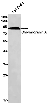 Chromogranin A Rabbit mAb