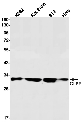 CLPP Rabbit mAb