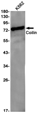 Coilin Rabbit mAb