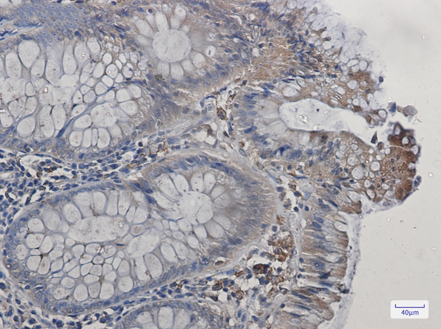 Cyclooxygenase 1 Rabbit mAb