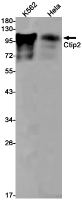 Ctip2 Rabbit mAb