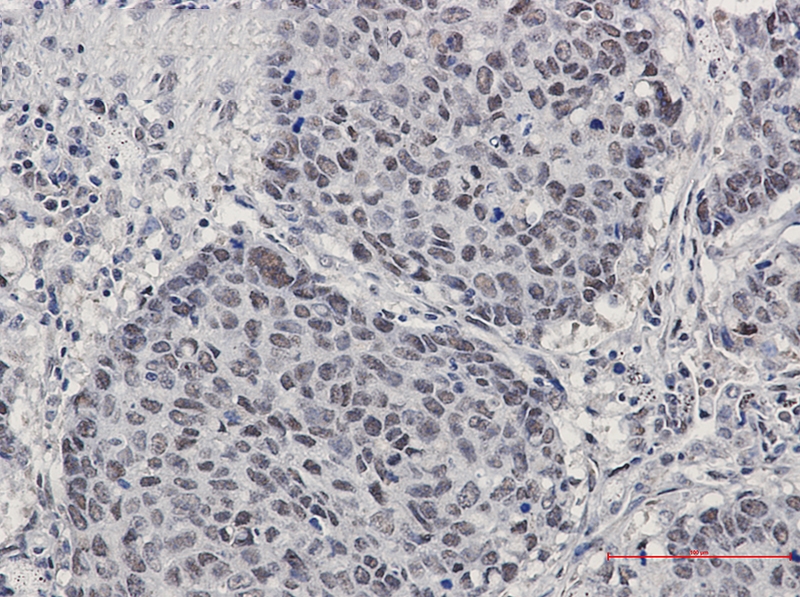 Cullin 4A/4B Rabbit mAb