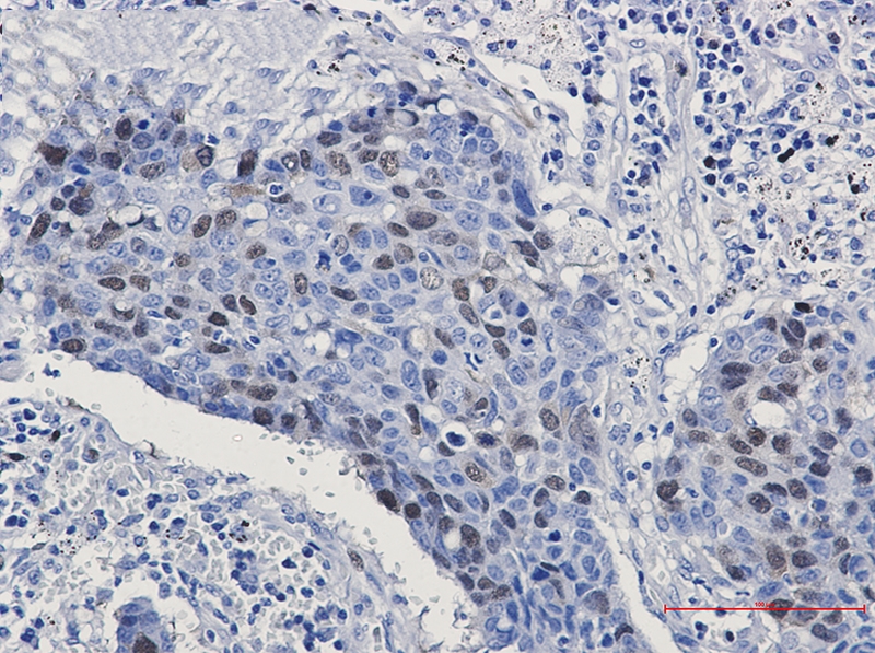 Cyclin A2 Rabbit mAb