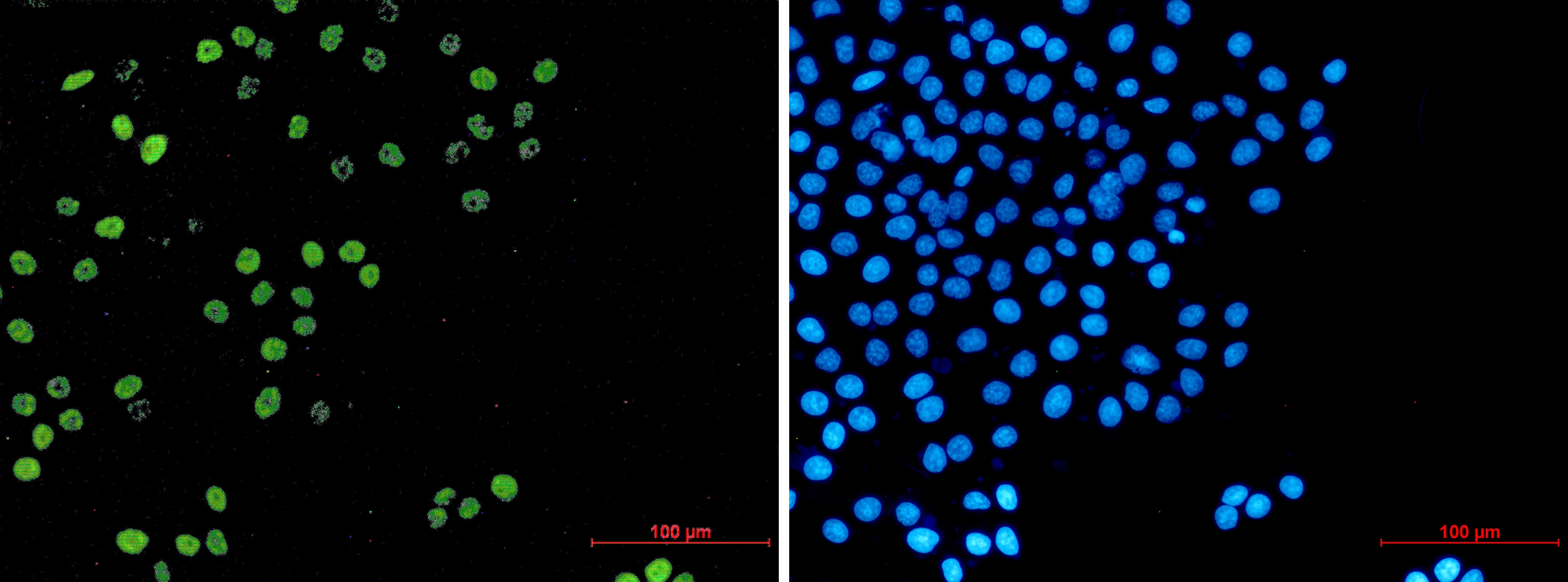 Cyclin A2 Rabbit mAb