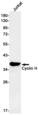 Cyclin H Rabbit mAb