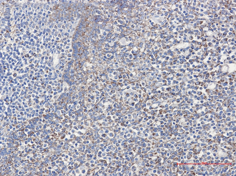 Cyclophilin F Rabbit mAb