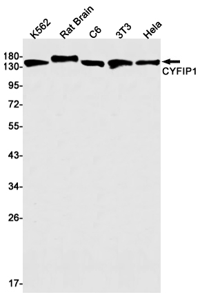 CYFIP1 Rabbit mAb