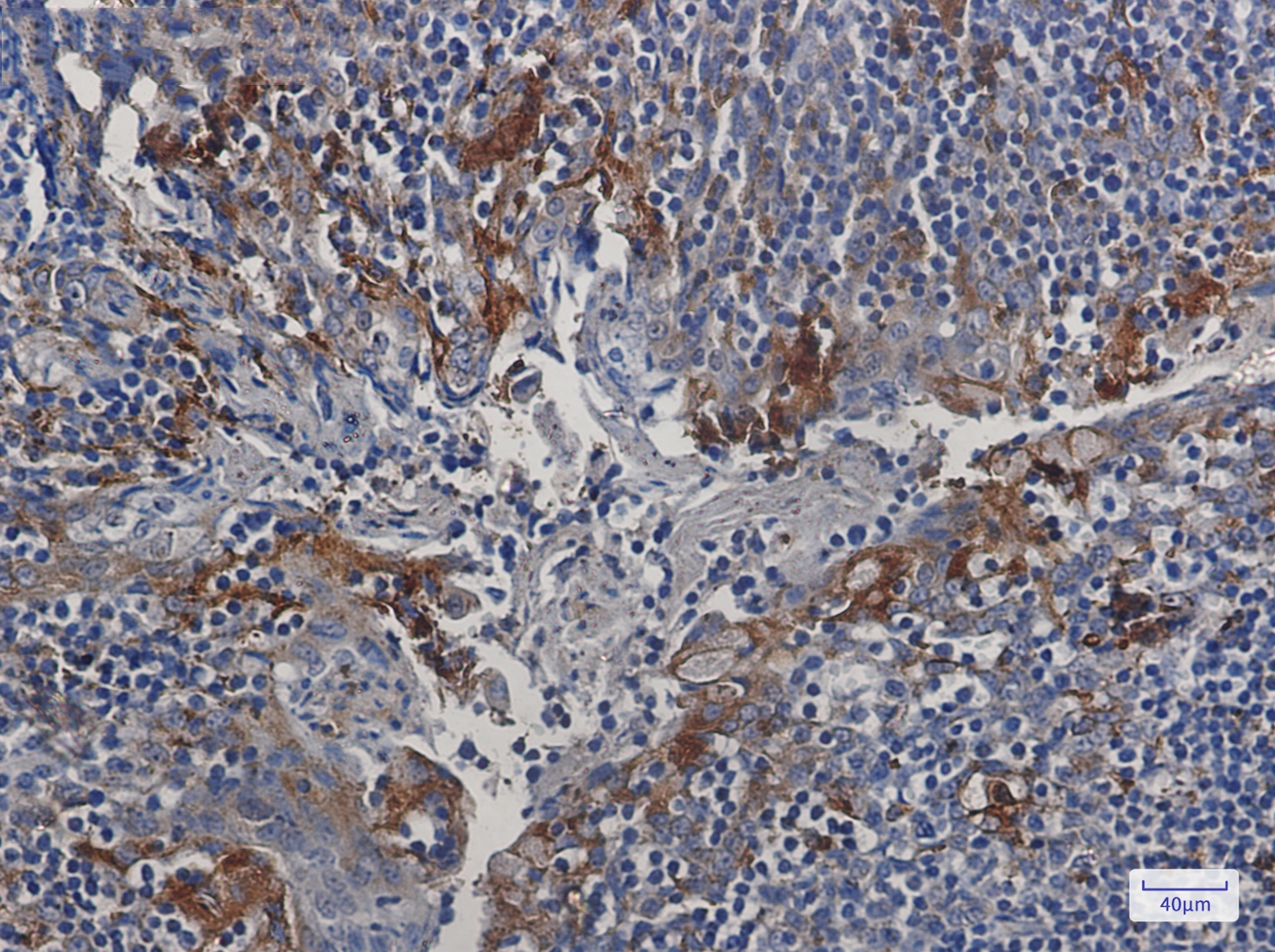 Cystatin C Rabbit mAb