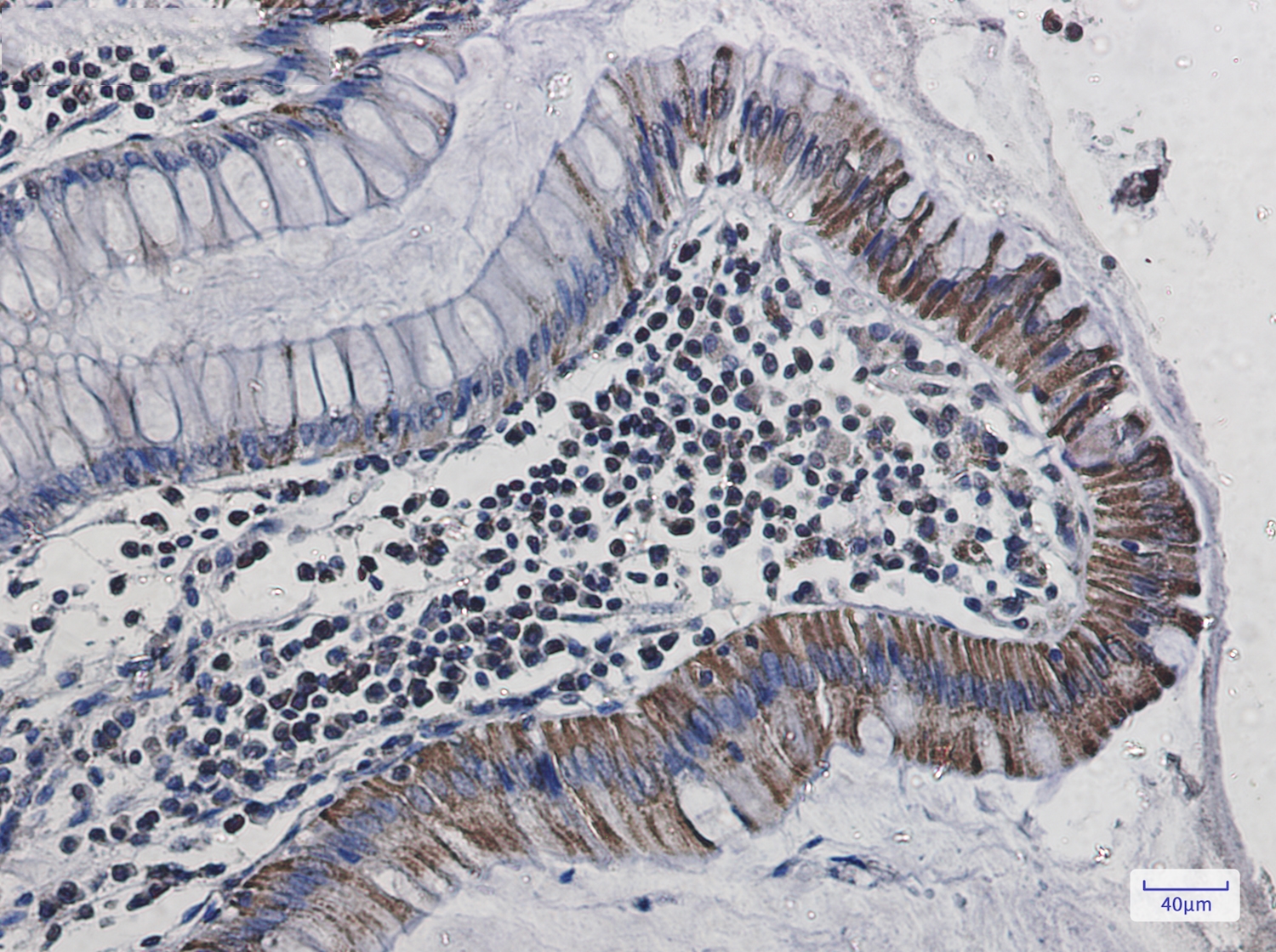 Cytochrome C Oxidase subunit Vic Rabbit mAb