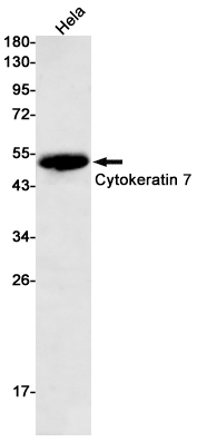 Cytokeratin 7 Rabbit mAb