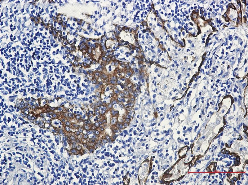 Cytokeratin 7 Rabbit mAb