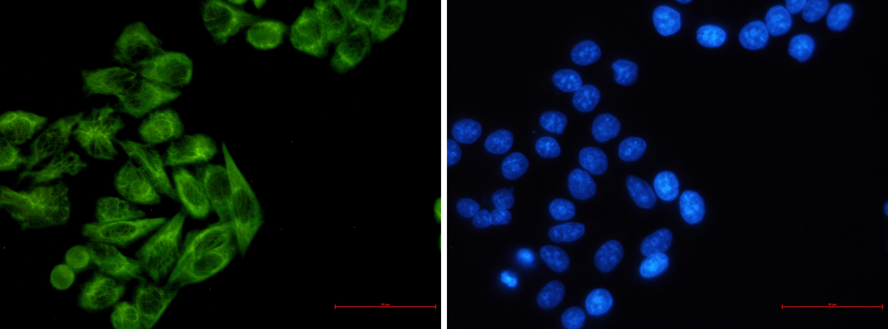 Cytokeratin 7 Rabbit mAb