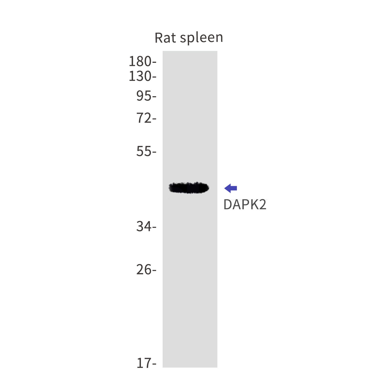 DAPK2 Rabbit mAb