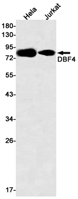 DBF4 Rabbit mAb