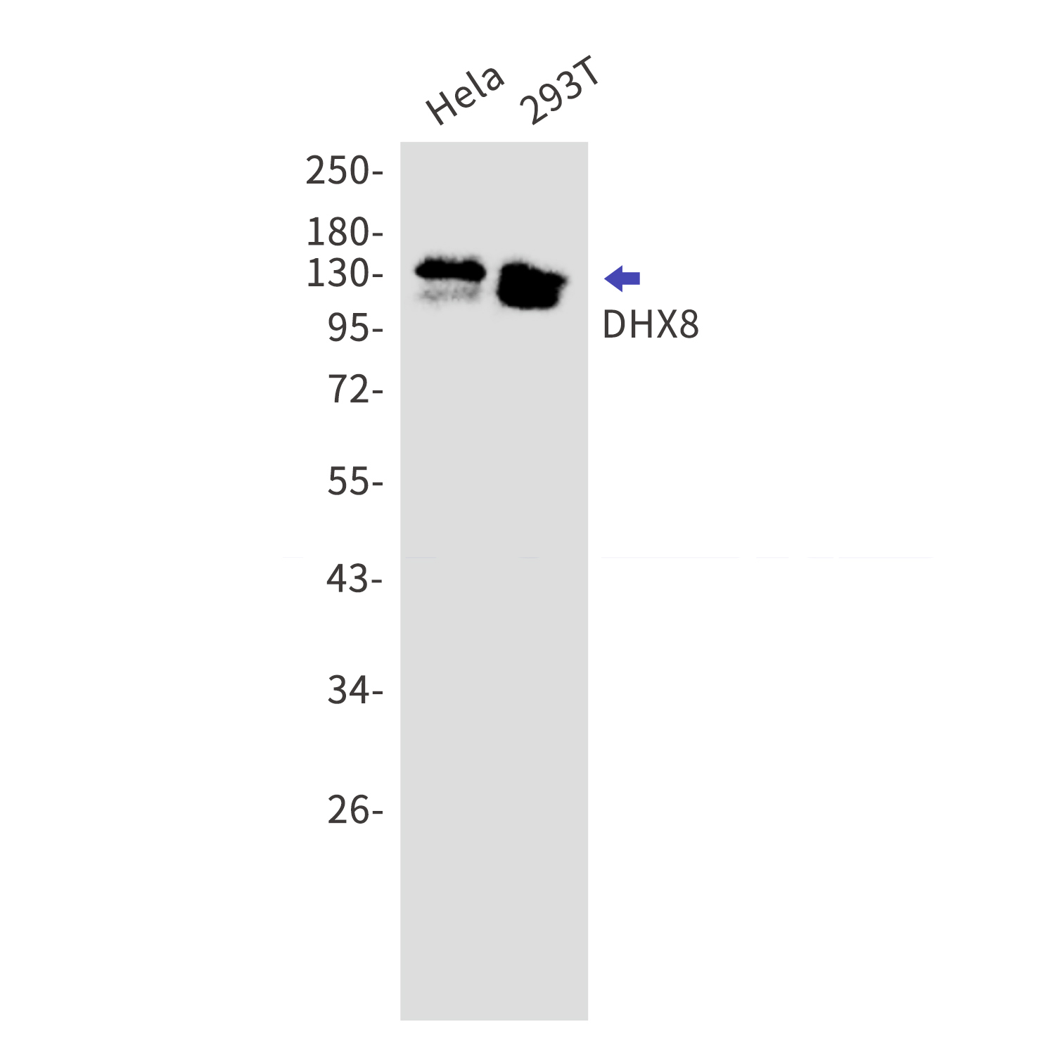 DHX8 Rabbit mAb