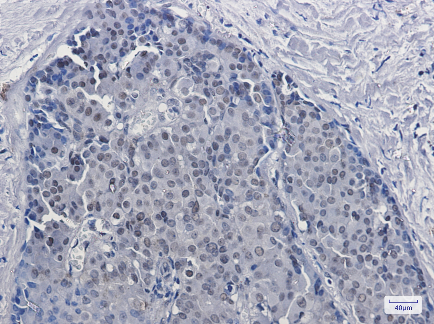 DKC1 Rabbit mAb