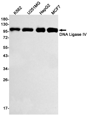 DNA Ligase IV Rabbit mAb