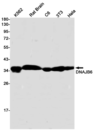 DNAJB6 Rabbit mAb