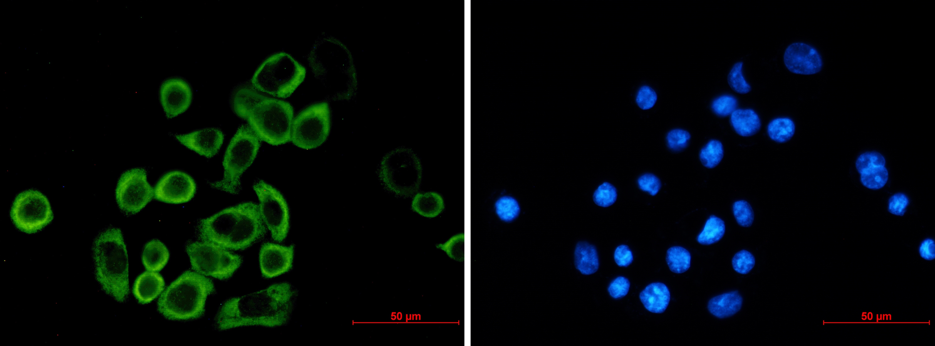 eIF2A Rabbit mAb