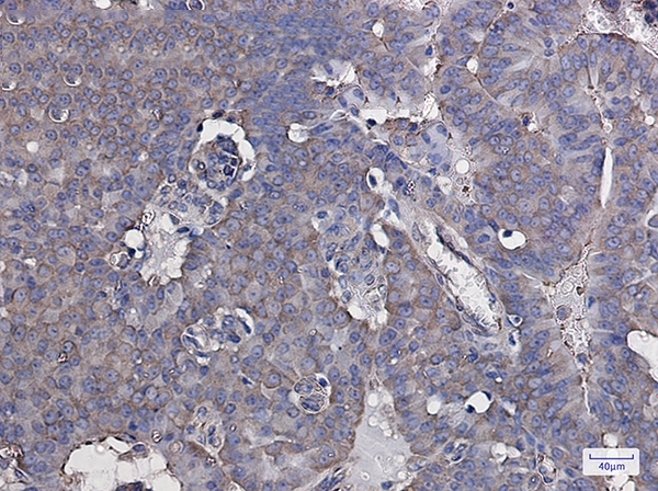 eIF3B Rabbit mAb