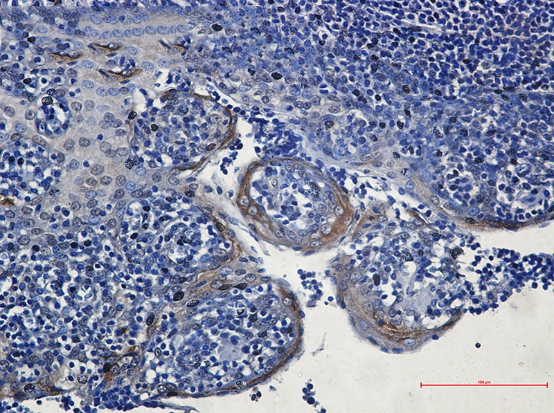 eIF4A3 Rabbit mAb