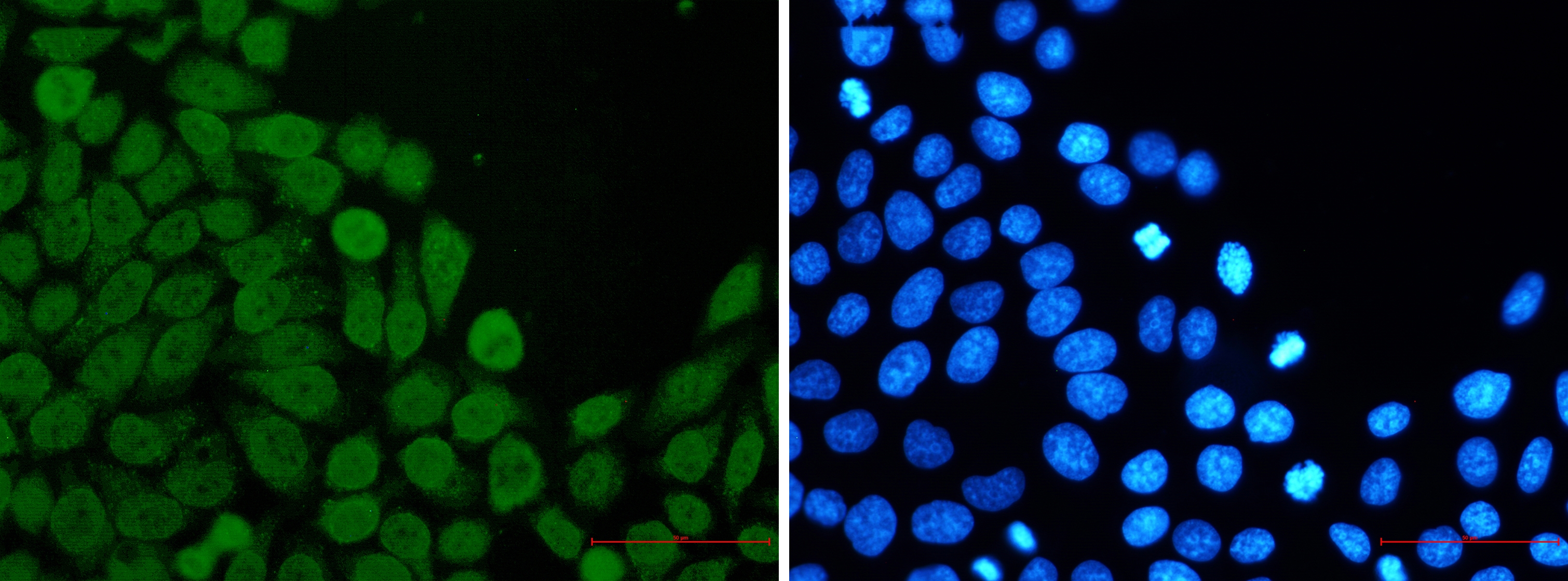 eIF4A3 Rabbit mAb