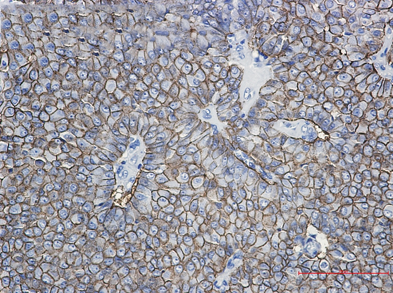 EpCAM Rabbit mAb