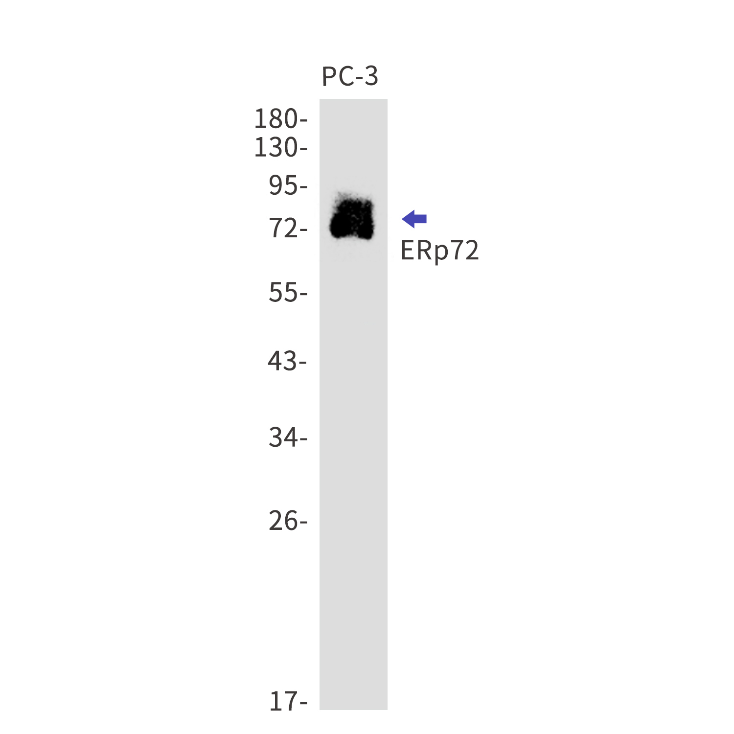 ERp72 Rabbit mAb