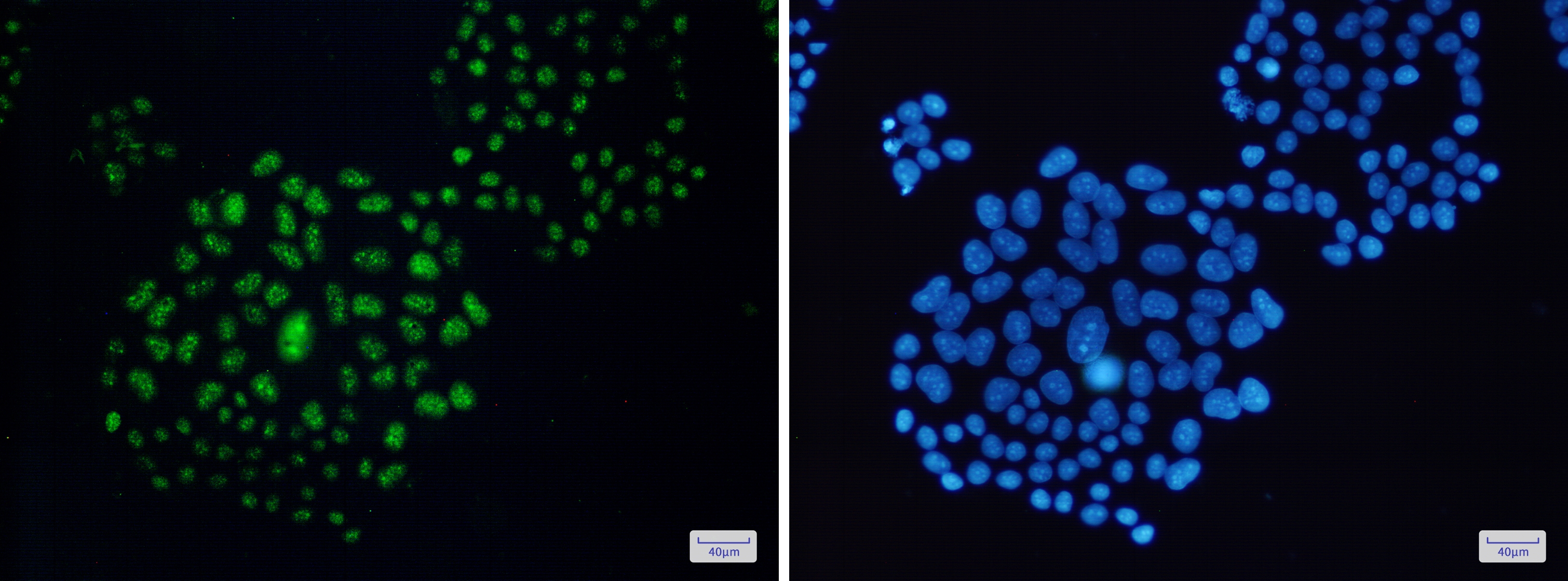 EWSR1 Rabbit mAb