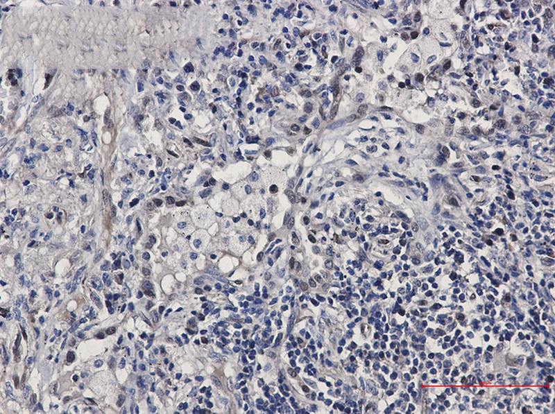 FDPS Rabbit mAb