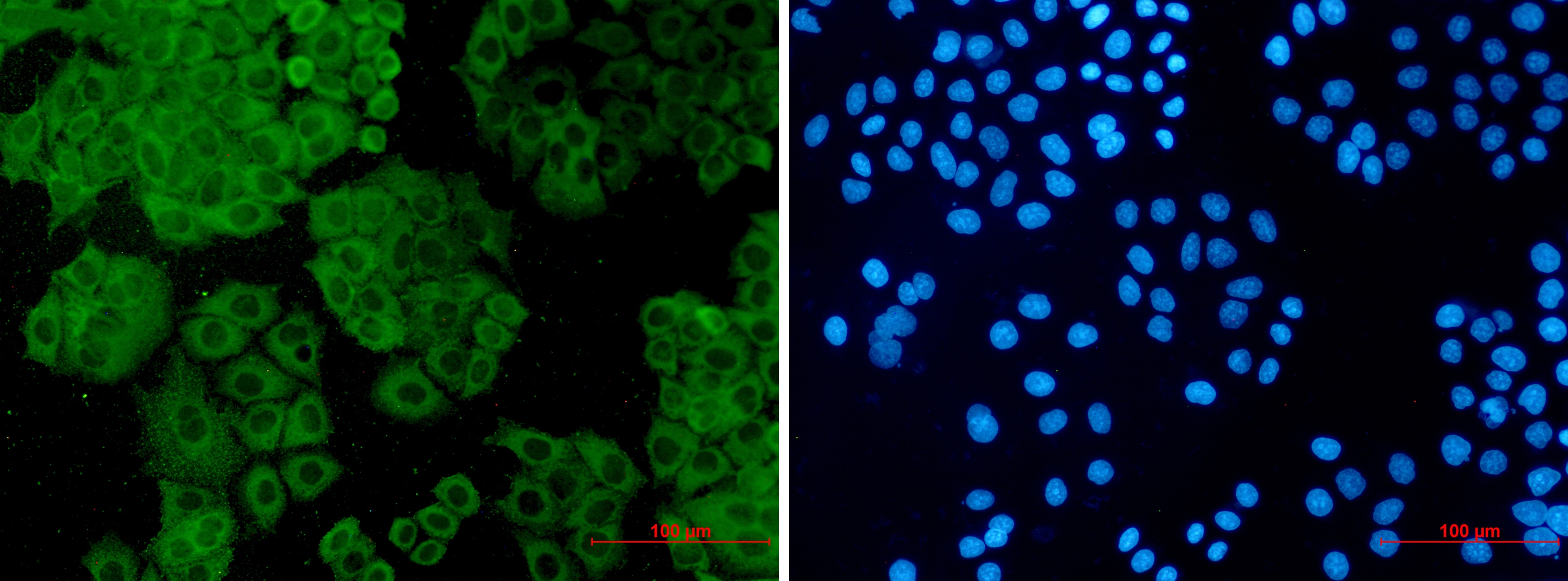 FH Rabbit mAb