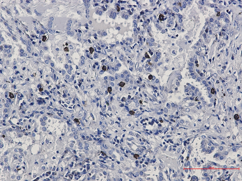 FLI1 Rabbit mAb