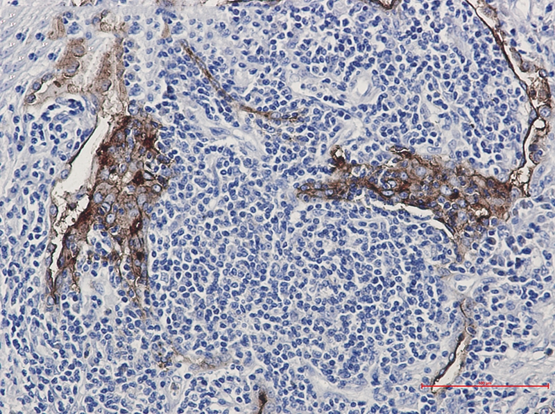 Folate Binding Protein Rabbit mAb